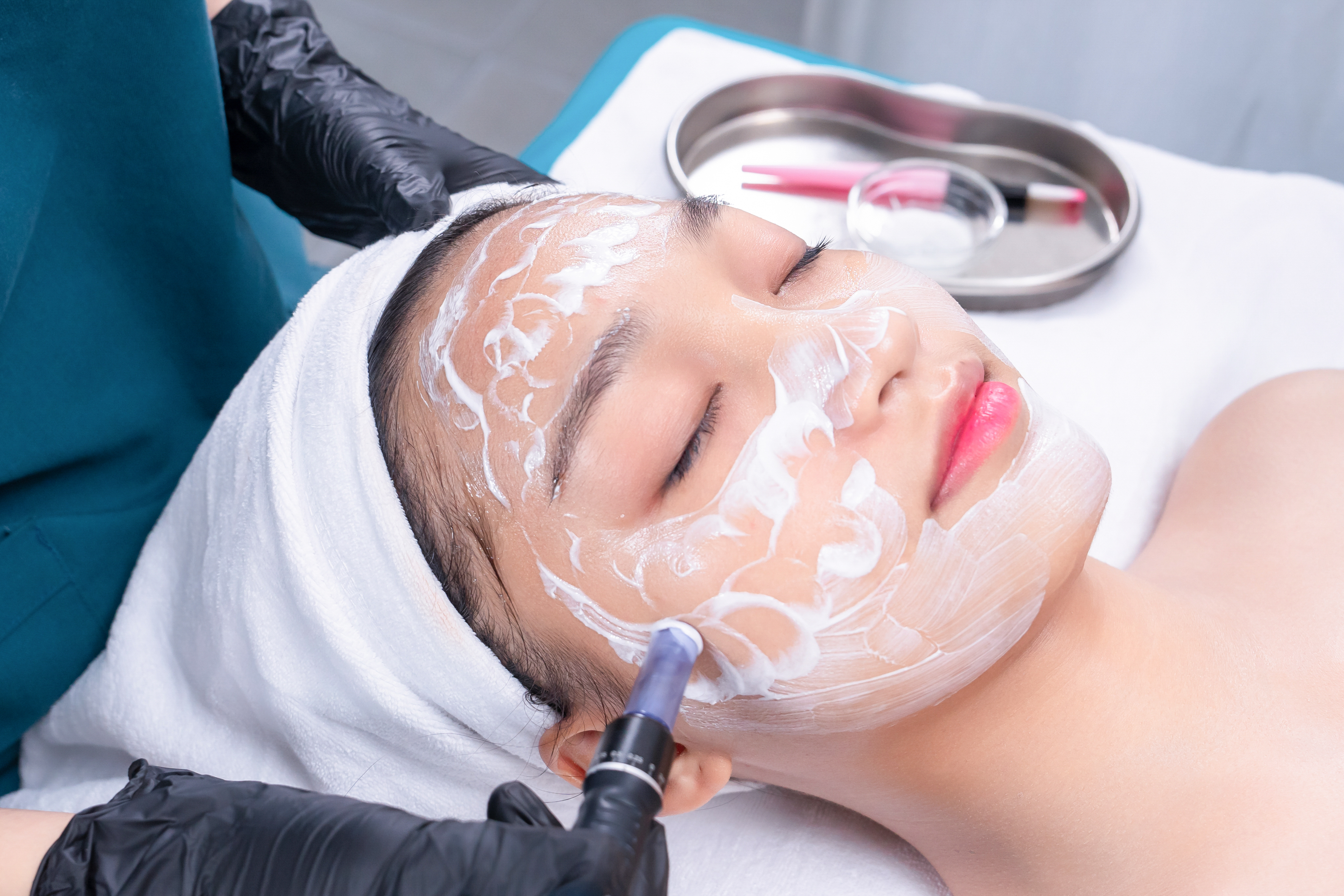 Cách Điều Trị Nám Da Hiệu Quả Nhất Hiện Nay
